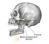 How much force does it take to break your jaw?