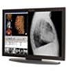 Planar Systems, Inc.