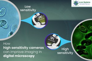 Why high sensitivity camera for digital microscopy-Image