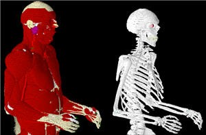 VariPose Biological Mesh Repositioning Software-Image