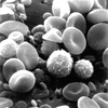 Liquid FETs Monitor Blood Chemistry