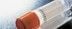 Vials-Image