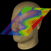 The Importance of Uncertainty Quantification-Image