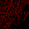 Mad City Labs, Inc. - Super-resolution microscopy