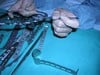 Protomatic, Inc. - Surgical Tools