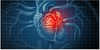 Portescap - The right motor for cardiovascular applications