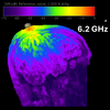 SAR Simulations of a Mock Brain Computer Implant-Image