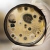 Fungus Contamination Testing-Image