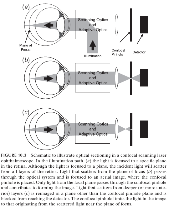FIGURE 10.3 Schematic to illustrate optical sectioning in a confocal scanning laser ophthalmoscope. In the illumination path, (a) the light is focused to a specific plane in the retina. Although the light is focused to a plane, the incident light will scatter from all layers of the retina. Light that scatters from the plane of focus (b) passes through the optical system and is focused to an aerial image, where the confocal pinhole is placed. Only light from the focal plane passes through the confocal pinhole and contributes to forming the image. Light that scatters from deeper (or more anterior) layers (c) is reimaged in a plane other than the confocal pinhole plane and is blocked from reaching the detector. The confocal pinhole limits the light in the image to that originating from the scattered light near the plane of focus.