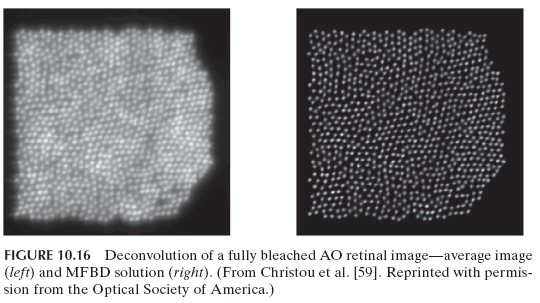 FIGURE 10.16 Deconvolution of a fully bleached AO retinal image&mdash;average image (left) and MFBD solution (right). (From Christou et al. [59]. Reprinted with permission from the Optical Society of America.)
