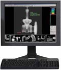 POWERFUL IMAGE ENHANCEMENT AND VIEWING-Image