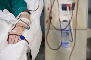 Solutions for Controlling Blood Flow -Image