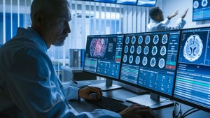 Article: AI and medical imaging-Image