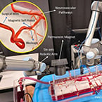 Magnet-guided soft robots offer safer way to treat deadly blood clots