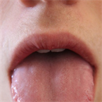 An artificial tongue for detecting, inactivating common mouth bacteria.