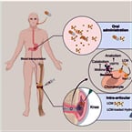 Injectable hydrogel eases osteoarthritis pain, restores cartilage
