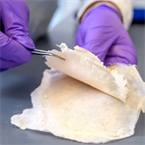 Nanofiber-coated cotton bandages fight infections, increase wound healing.