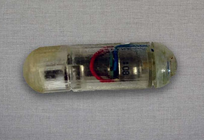 Ingestible, vibrating device promises to prevent overeating.
