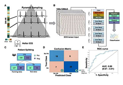 AI tool promises to predict fatal heart rhythm.