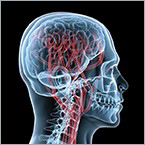 Improving neurovascular microcatheter production