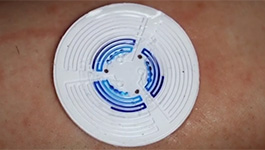 Cystic fibrosis diagnosis by skin-worn sticker.