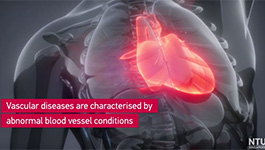 How AI, microfluidics combine to detect vascular diseases.